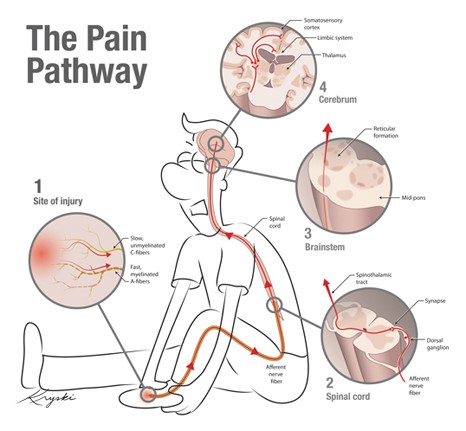 Pain Management